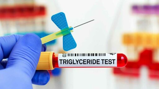provetta sangue per test trigliceridi