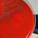 streptococco, un patogeno molto serio