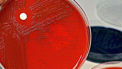 streptococco, un patogeno molto serio