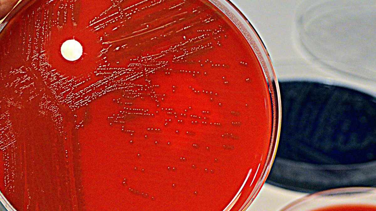 Chi ha preso lo streptococco può prendere la scarlattina?