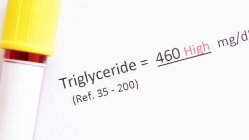 test trigliceridi appunto con valori su carta in inglese