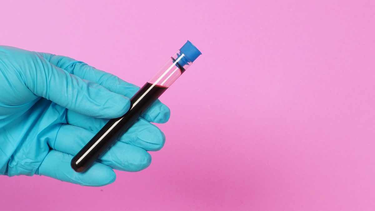 trigliceridi da analizzare in provetta di sangue prelevato