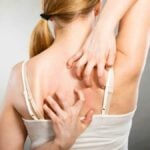 woman scratching her itchy back with allergy rash