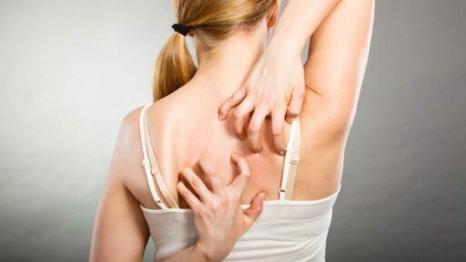 woman scratching her itchy back with allergy rash