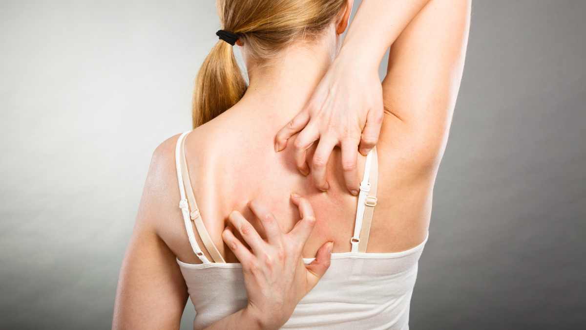 How do infection rashes look like?