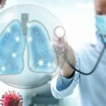 Polmonite - grafica con medico, virus e illustrazione polmoni