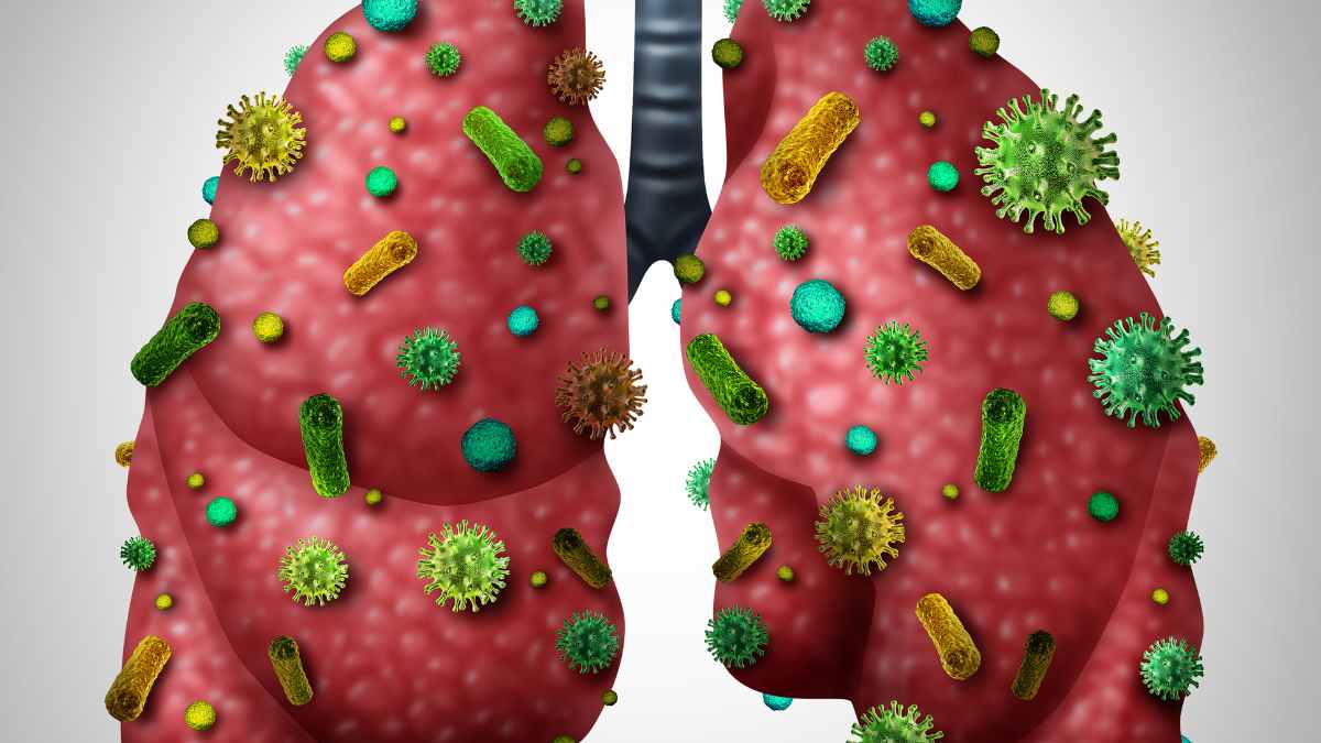 Quali sono i sintomi di una polmonite senza febbre?