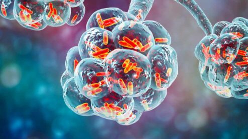 Come aumentare le difese immunitarie per i polmoni?