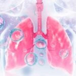 Polmonite - infezione da virus e batteri