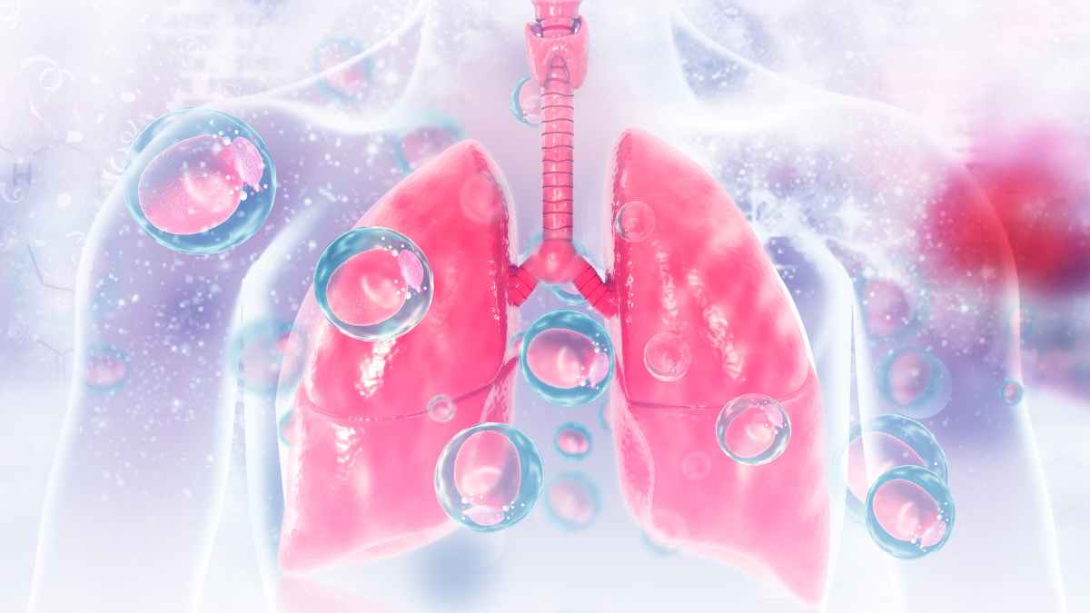 Polmonite - infezione da virus e batteri