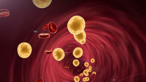 globuli di Colesterolo nel sangue