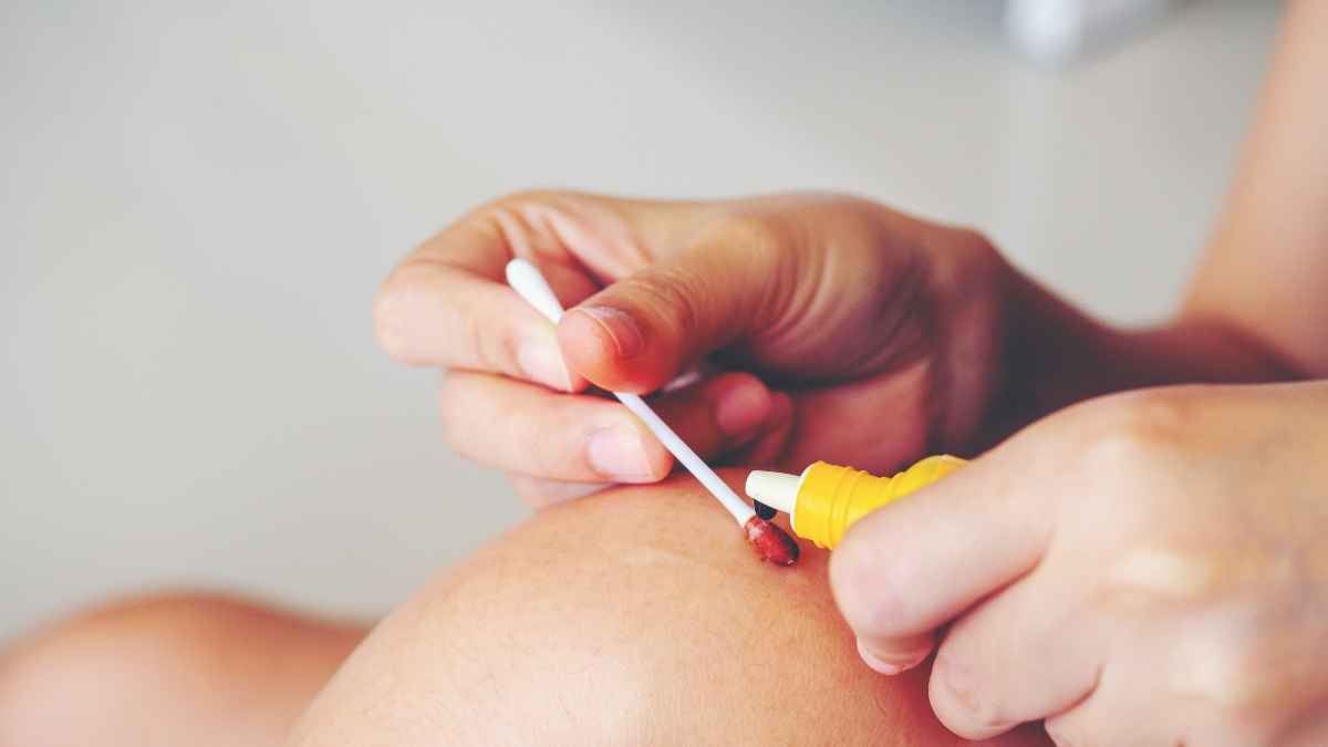 Quando usare il cicatrizzante?