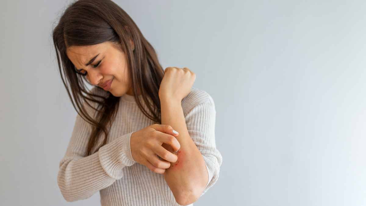 eczema prurito al braccio ragazza