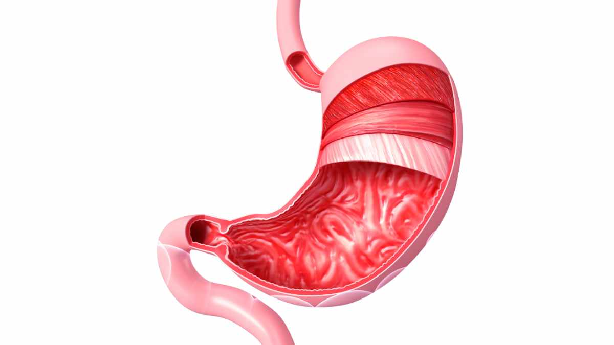 Cosa prendere per un forte mal di stomaco?