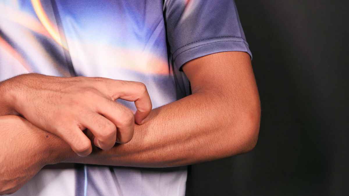Perché la sera viene il prurito?