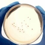 Infezioni batteriche - campione di batteri