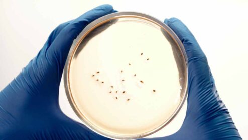 Quali sono i sintomi dell’infezione da Escherichia coli?