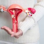 Endometriosi