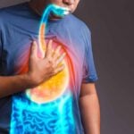 reflusso gastroesofageo e gastrite