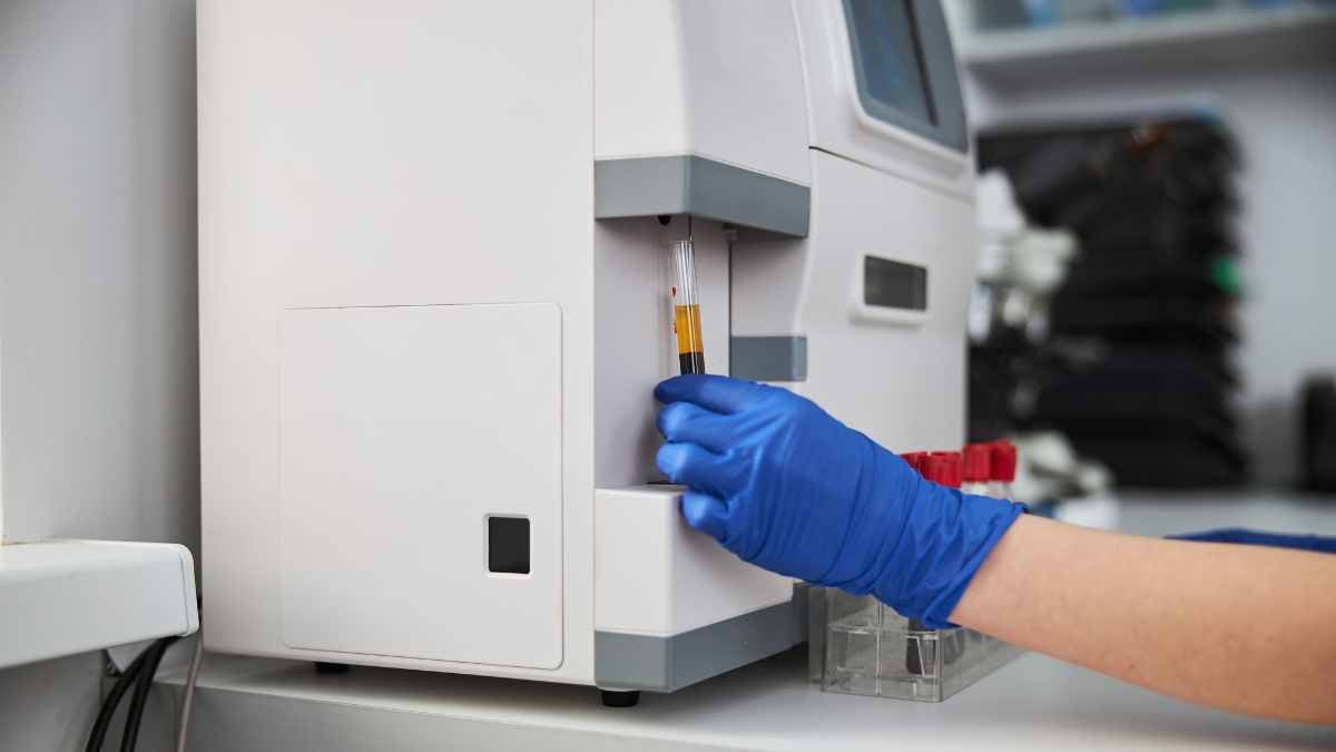 Analisi campioni in laboratorio di Ematologia
