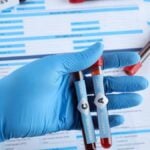 Campioni ematici per l'analisi in laboratorio di Epatologia