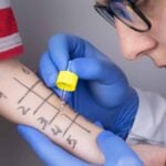 Esame di prove allergiche su bambino in visita di Allergologia