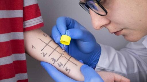 Esame di prove allergiche su bambino in visita di Allergologia