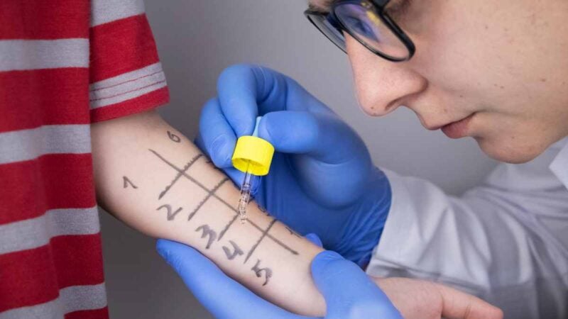 Esame di prove allergiche su bambino in visita di Allergologia