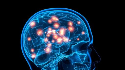 Neurologia - grafica computerizzata di cervello e impulsi elettrici