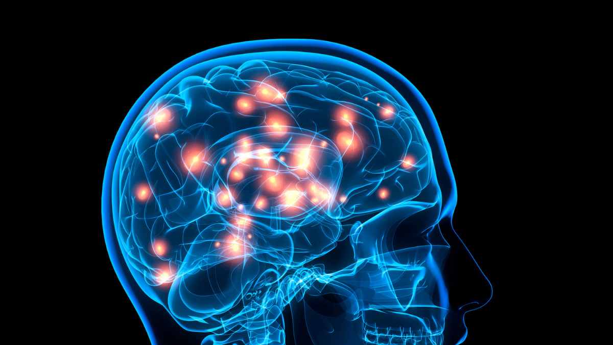 Neurologia - grafica computerizzata di cervello e impulsi elettrici