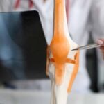 modello anatomico in uso in ambulatorio di Reumatologia