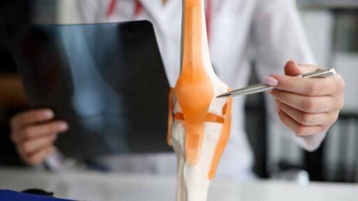 modello anatomico in uso in ambulatorio di Reumatologia
