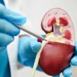 modello anatomico in uso in reparto di Urologia