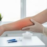 Dermatite atopica negli adulti: sintomi e terapie innovative