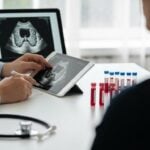 Ipotiroidismo subclinico: quando iniziare la terapia