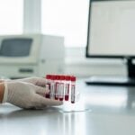 Neoplasie mieloproliferative: sintomi e trattamenti