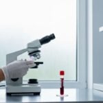 Anemia aplastica: sintomi e nuove terapie