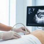 Cancro al pancreas: diagnosi precoce e terapie