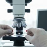 Leucemia linfatica cronica: diagnosi precoce e terapie