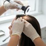 Semaglutide e perdita di capelli: cosa sapere