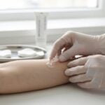A cosa serve il calcipotriolo?