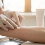 A cosa serve il Dermirit crema?