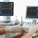 Miocardite: sintomi, diagnosi e gestione