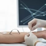 Sindrome di Lambert-Eaton: sintomi e trattamenti
