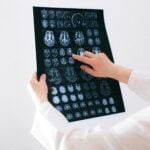 Meccanismo d'azione dell'escitalopram sul sistema nervoso centrale