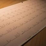 Metodi per Ridurre le Aritmie Cardiache