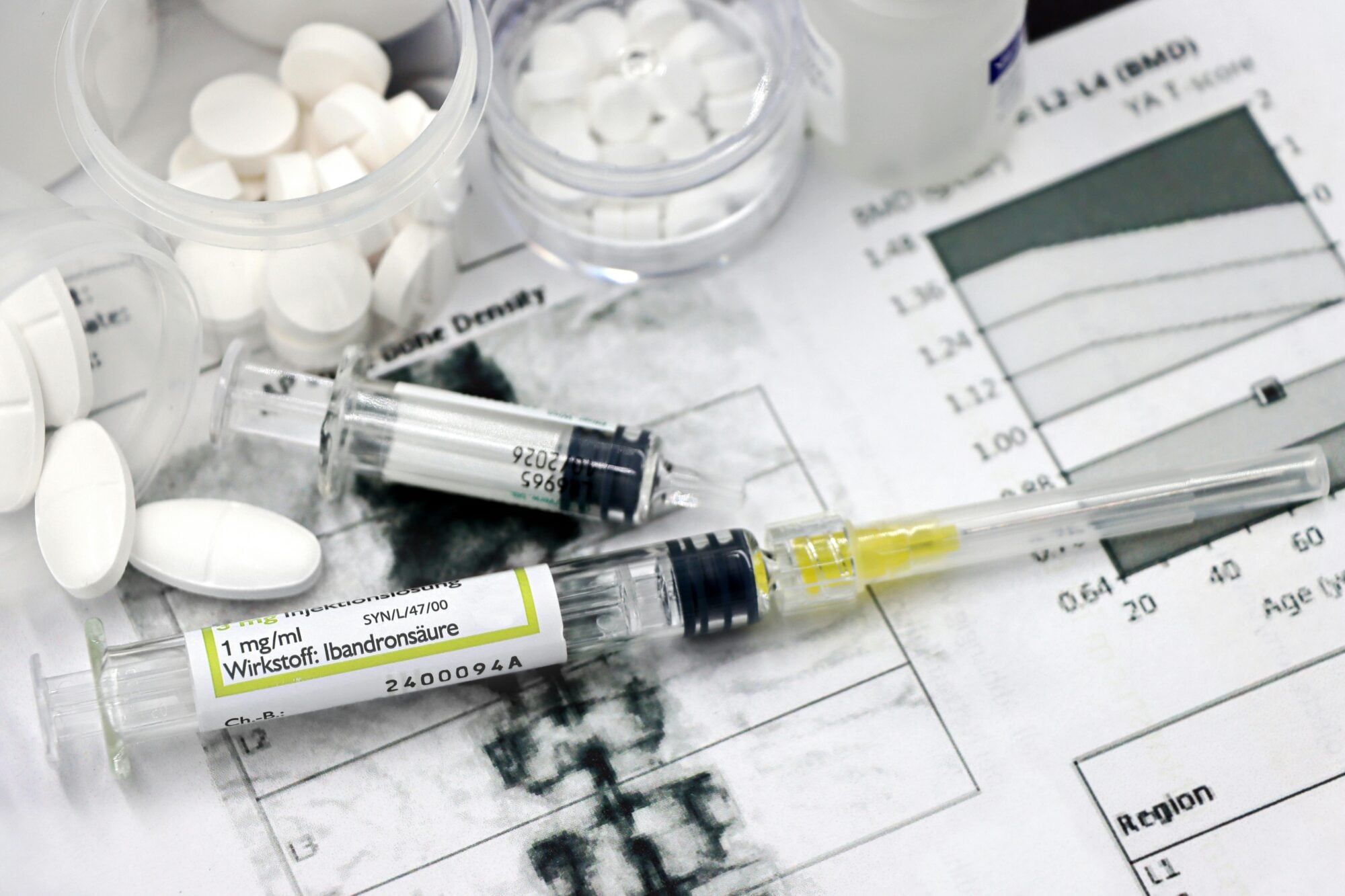 Strategie per aumentare la massa ossea