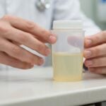 Strategie per ridurre il glucosio nelle urine