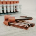 Che cos’è la creatinina, perché si misura nel sangue e nelle urine e quali sono i valori normali