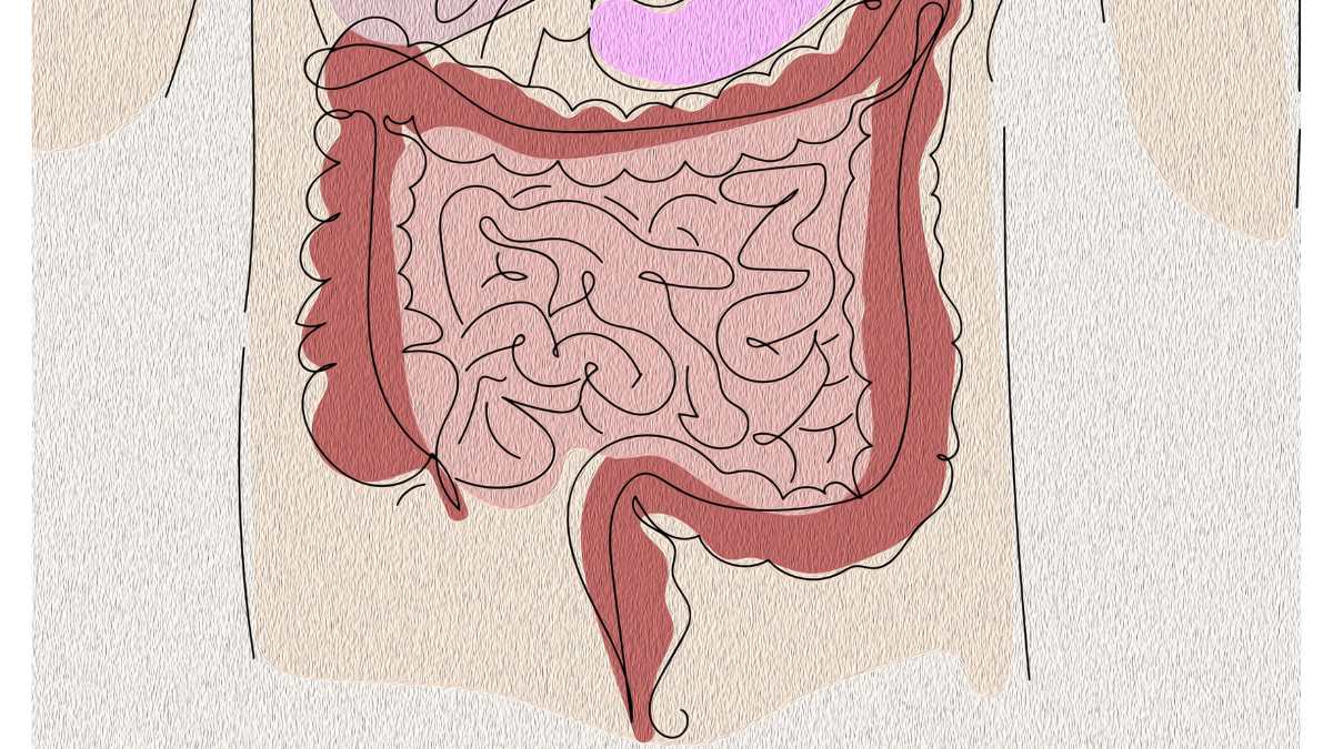 Di che colore possono essere le feci in caso di tumore al colon